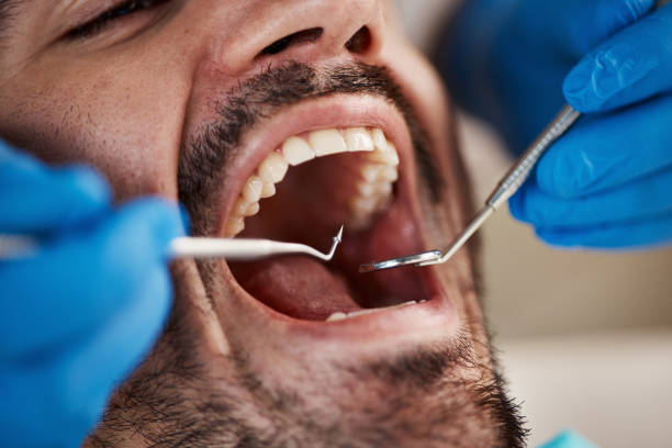 Best Oral Cancer Screening  in Martinsville, NJ